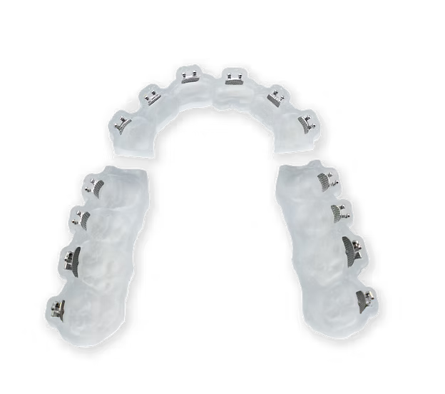 Two translucent dental guides with metal brackets for orthodontic use, arranged in an arch formation on a black background.